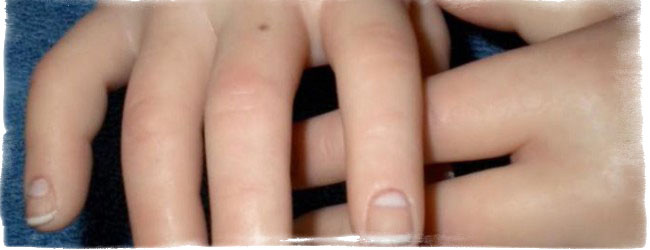 родинка на среднем пальце правой руки значение