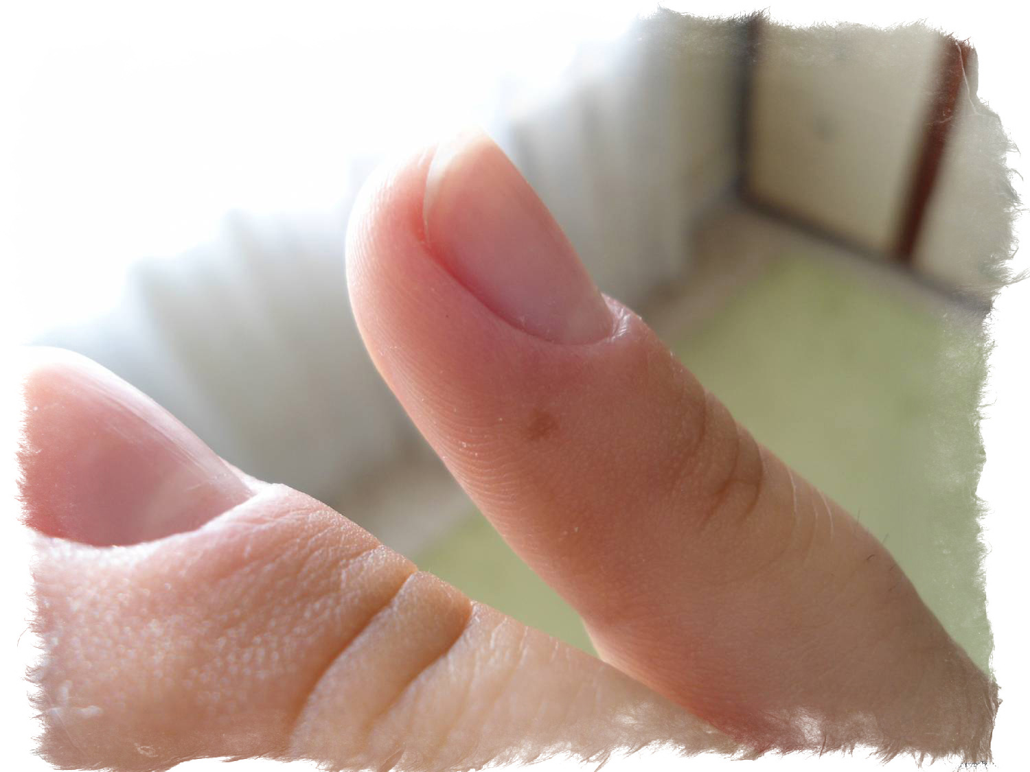 Значение родинок на безымянном пальце левой руки thumbnail